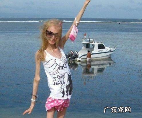 减肥之后患上厌食症 25岁减肥得厌食症