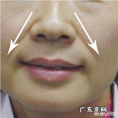 17岁就有法今纹该怎么去除,有哪些护肤经验分享吗