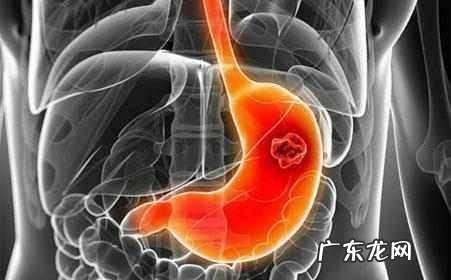 你们的口臭最后都是怎么完全好的可以分享一下经验吗