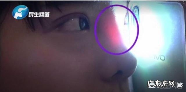 肋软骨隆鼻有哪些并发症,会被吸收吗,会不会弯曲变形