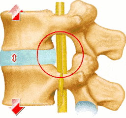 每天工作时间太长，感觉有点腰肌劳损，拉伸可以缓解吗
