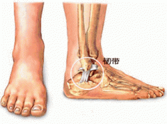 踝关节扭伤可否立即做推拿