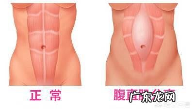 产后肚子太大到底是脂肪多还是肥肉多,怎样才能减掉