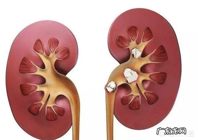 哪种食物,能有效降低尿酸,是痛风的天敌