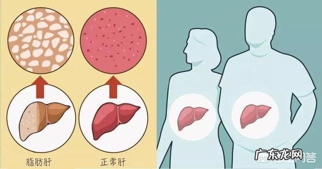 腹腔积液癌细胞脱落是怎么回事