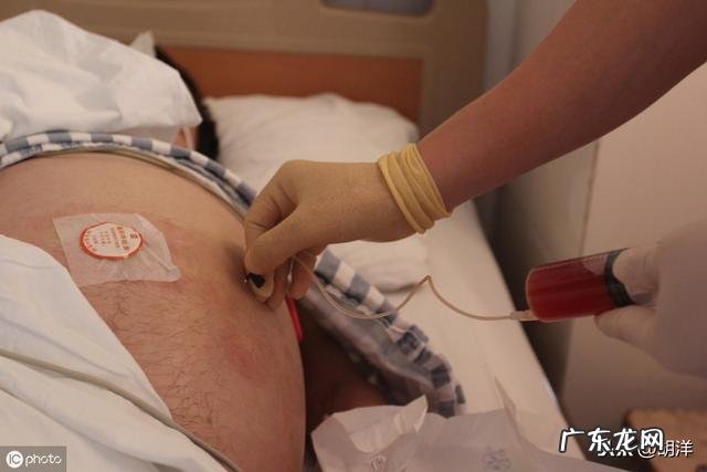 腹腔积液癌细胞脱落是怎么回事