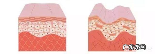 美容按摩仪器都有什么,真的有用吗