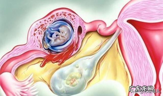 为什么试管婴儿也有生化妊娠