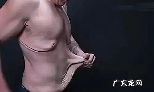 减肥后,肚皮会不会很松弛