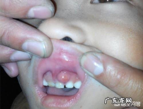 自己的下牙大部分都松动了，这是怎么回事