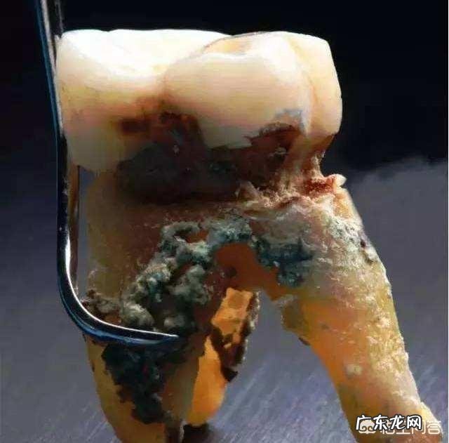 自己的下牙大部分都松动了，这是怎么回事