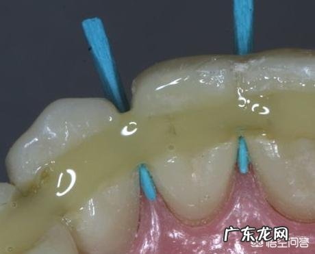 自己的下牙大部分都松动了，这是怎么回事