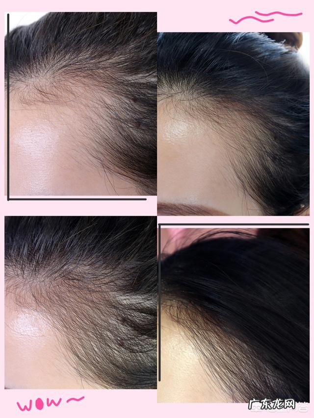 为什么说产后修复是女人的“第二次生命”呢