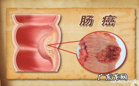 有没有孕妈整个孕期都没有忌口,生下来的宝宝一样漂亮