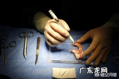 肋软骨隆鼻后可以被吸收吗