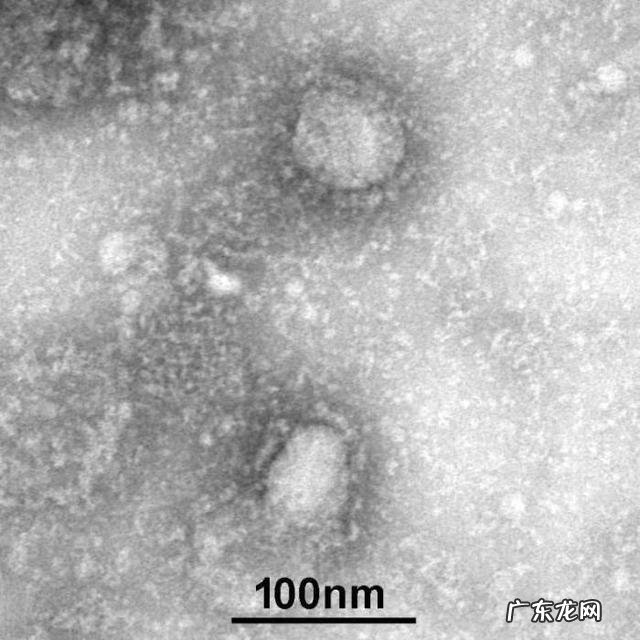 预防新型冠状病毒 喝盐水可以预防新型冠状病毒
