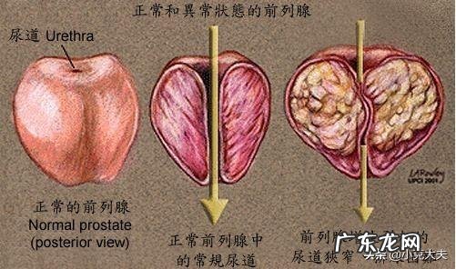 男人生活中应该注意哪些健康问题如何预防