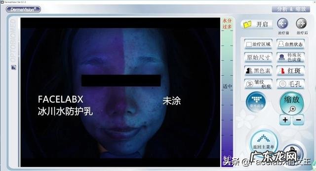 哪一款胶原蛋白可以祛斑，有推荐的吗