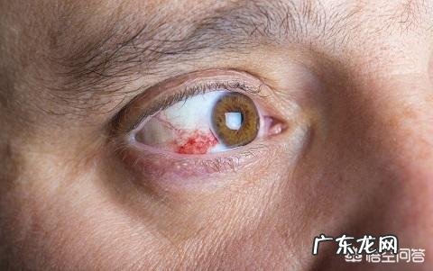 夜班吃了皮蛋口吐血迹怎么回事