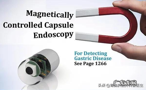 胶囊肠镜看的全面吗,和传统的肠镜比如何