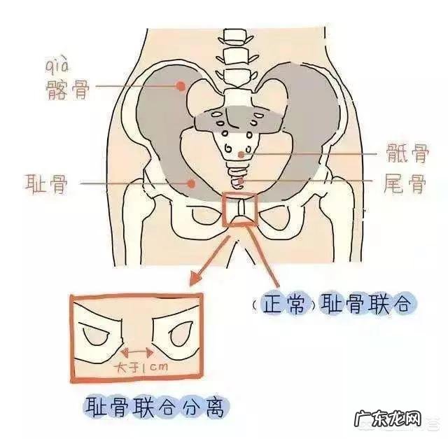 孕妈们产后屁股下垂、胯变宽、假胯宽,还有救吗