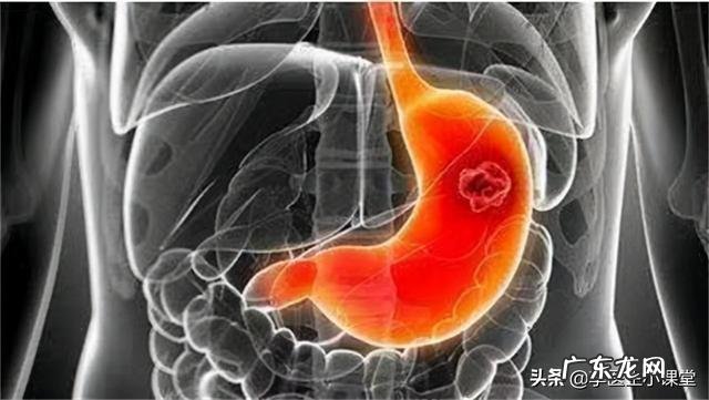 布洛芬可以治腰椎痛吗 布洛芬片可治腰腿疼痛吗