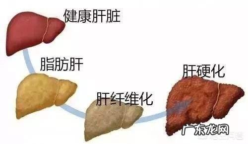 丙氨酸氨基转移酶高是怎么回事