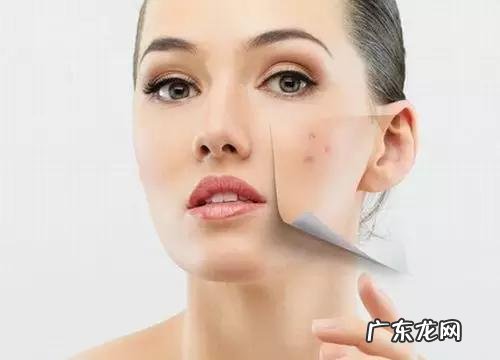 脸上痘印多且肤色不均匀,应该怎么办