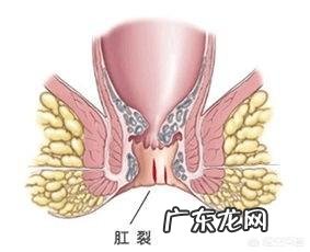 大便有鲜红血,这是为什么