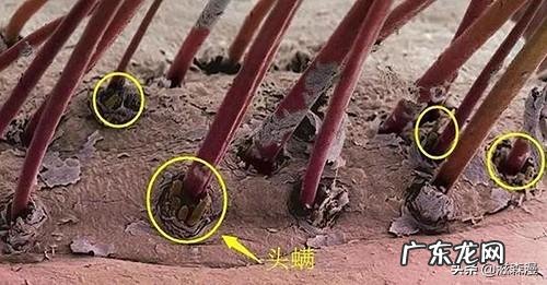 为什么头发3天不洗,头皮就会很痛