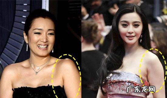 手臂上的赘肉通过肌肉训练是可以去掉的吗