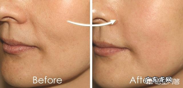 脸上去皱纹最好的方法是什么
