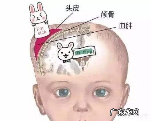 跳健美操后胳膊、腿疼还有点浮肿,怎么办