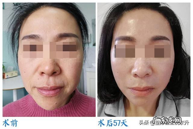 想要抗初老提拉紧致有哪些推荐的护肤品