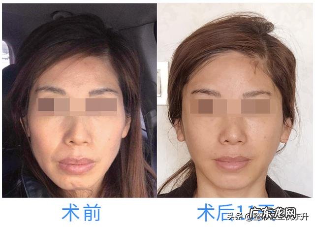 想要抗初老提拉紧致有哪些推荐的护肤品