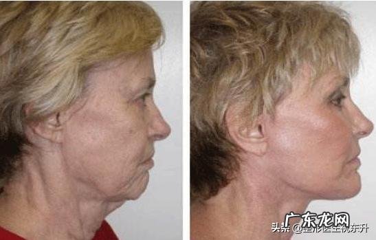 想要抗初老提拉紧致有哪些推荐的护肤品