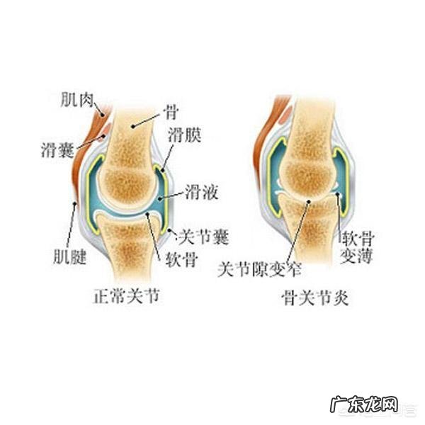 如何能更好的护理膝关节炎患者
