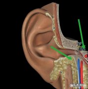 睡觉时耳鸣很厉害，感觉都吵得我睡不着觉了，怎么解决呢