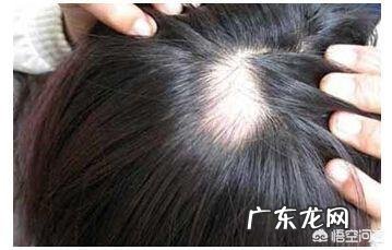 产后三个月了为啥开始掉头发了可怕!大家产后掉不掉头发怎么办呢