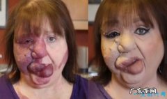 世界上最恶心的人 盘点世界上最丑最恶心的人