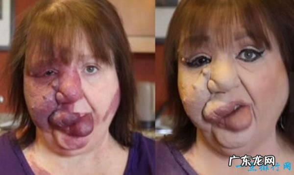 世界上最恶心的人 盘点世界上最丑最恶心的人