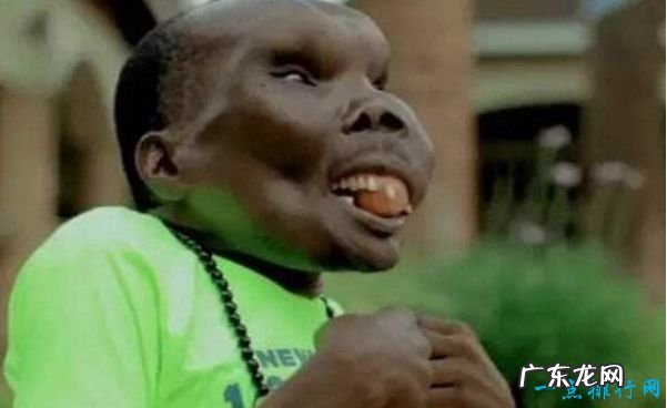 世界上最恶心的人 盘点世界上最丑最恶心的人