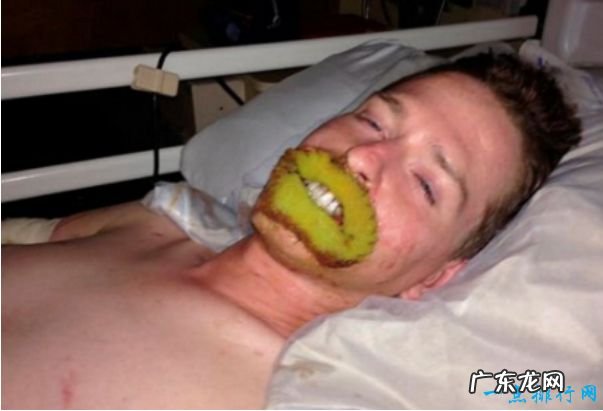 世界上最恶心的人 盘点世界上最丑最恶心的人