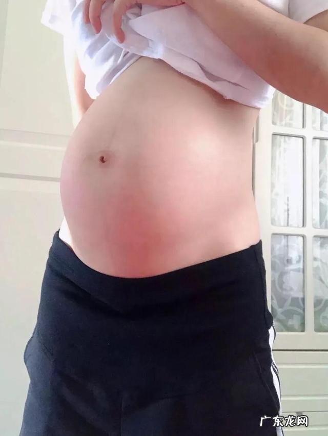 生完小孩,出现了产后漏尿,请问你日常饮食有需要注意的地方吗