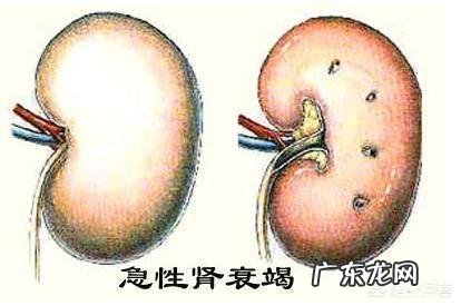 肾功能衰竭的时候为什么会有大量蛋白尿排出而同时伴有高钾血症