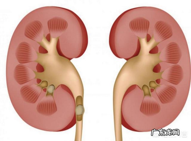 吃西药把尿酸降下来了,但痛风还是会发作,这是为什么