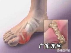 吃西药把尿酸降下来了，但痛风还是会发作，这是为什么