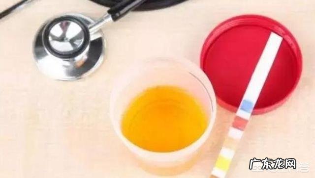 吃西药把尿酸降下来了,但痛风还是会发作,这是为什么