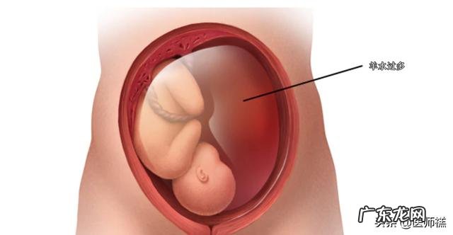 哪些人容易患上妊娠糖尿病