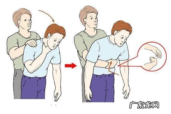 有哪些必须会的庭急救常识?